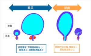 神経因性膀胱とは何ですか?